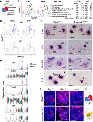 Smarca4 deficiency induces Pttg1 oncogene upregulation and hyperproliferation of tubular and interstitial cells during kidney development